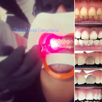 Endodoncia - material promocional